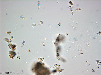 phyto/Bizerte/bizerte_bay/RISCO February 2015/Plagiotropis sp4 (ancien Baie_T5_CWD2_taxon_pennée1160129_001_ovl-2).tif(copy)_thumb.jpg